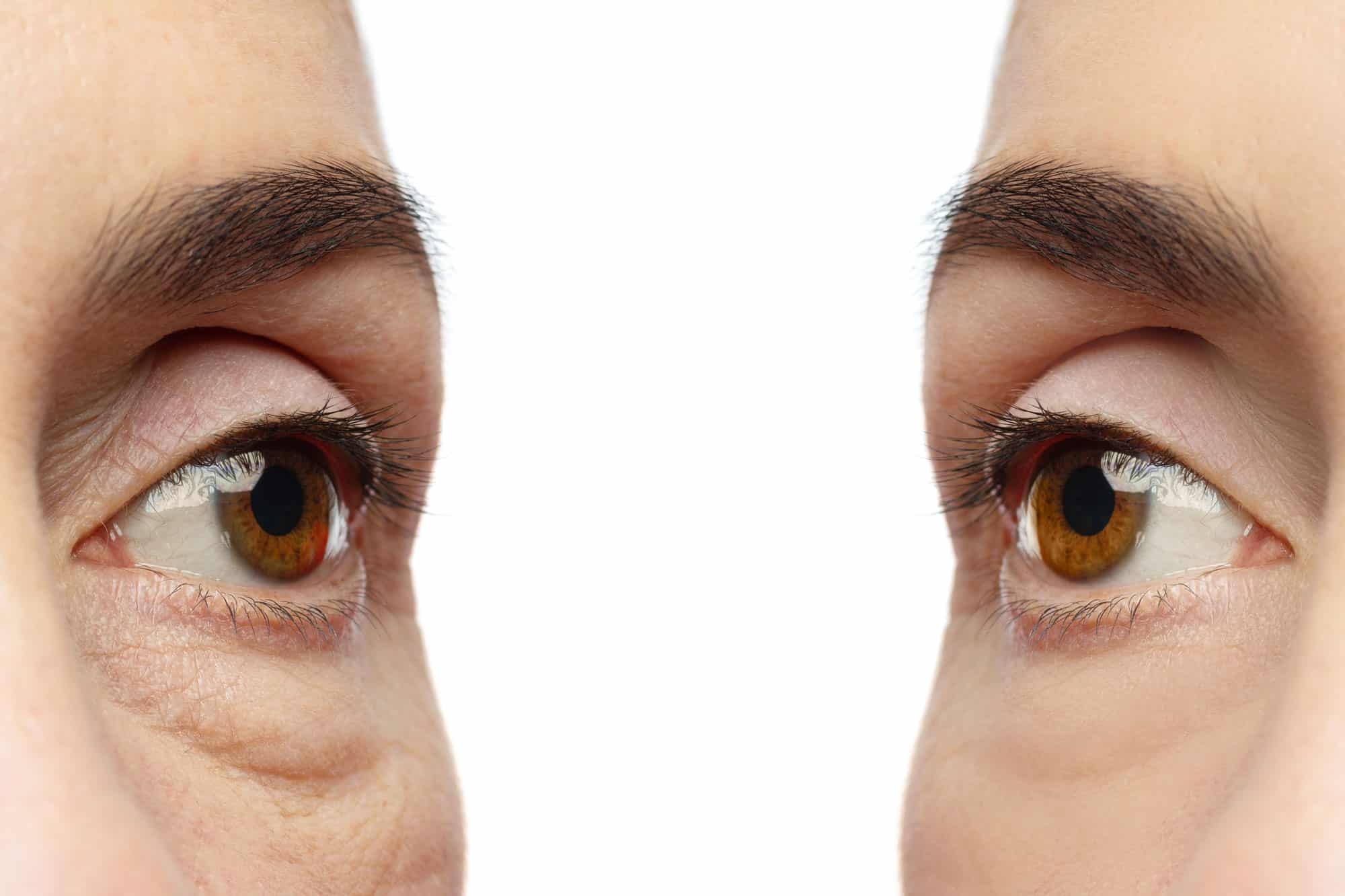 Augenkonturserum Mit 8% Koffein – 15 Ml, Mit Rollerball, Gegen Augenringe & Falten