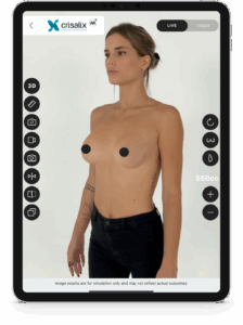 3D-Simulation Brustvergr&ouml;&szlig;erung &ndash; Vorher-Nachher-Vorschau mit Crisalix