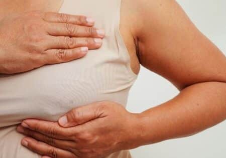 Hängebrust (Ptosis mammae ) – Ursachen, Grade und Behandlung