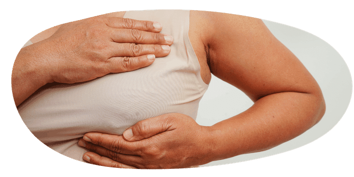 Hängebrust (Ptosis mammae ) – Ursachen, Grade und Behandlung