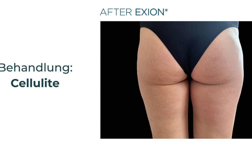 Plastische Chirurgie Tübingen