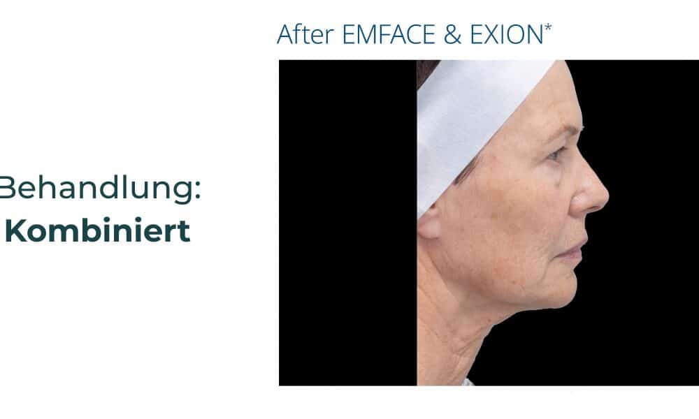 Plastische Chirurgie Tübingen