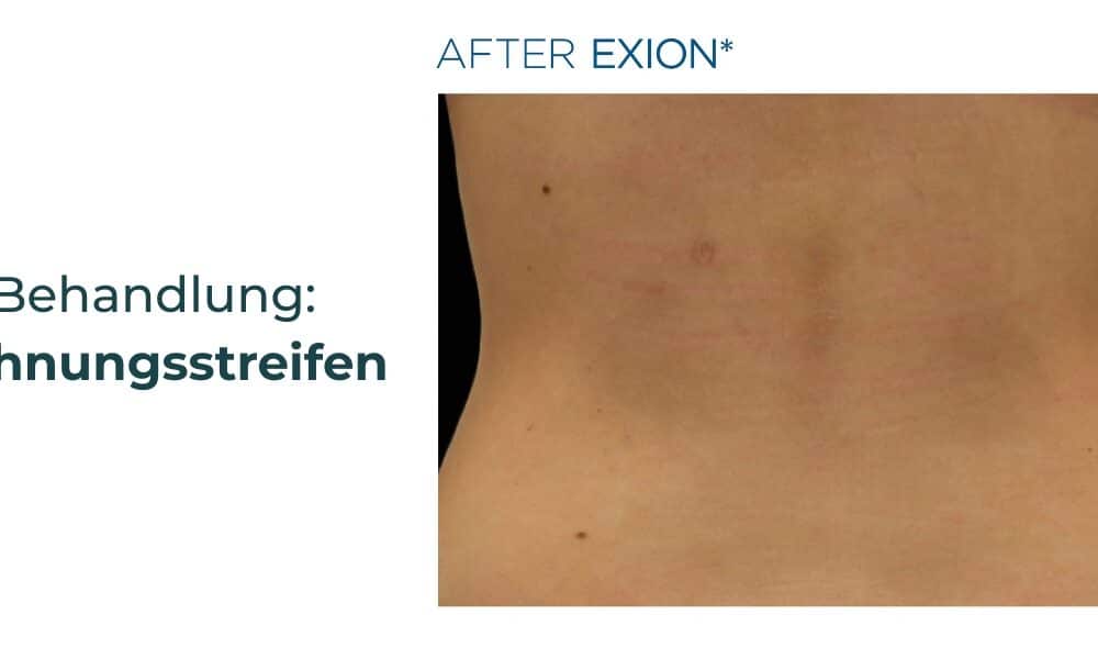 Plastische Chirurgie Tübingen