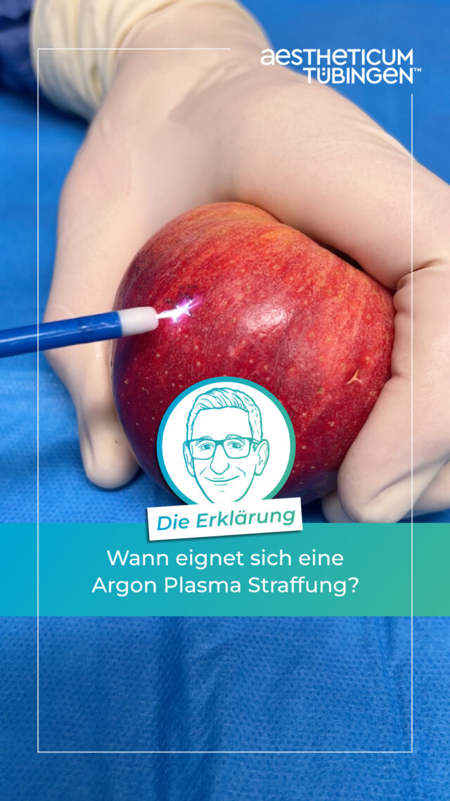 Wann eignet sich eine Argon Plasma Straffung?

Du bist an der Hautstraffung mit Argon Plasma interessiert, aber unsicher, ob das die passende Behandlung für dich ist? Oder vielleicht weißt du noch gar nicht, dass die Argon Plasma Straffung genau richtig für dich wäre? Dann gibt’s hier noch ein paar Einblicke - natürlich geht nichts über die persönliche Beratung.

#aestheticumtübingen #tübingen #plastischechirurgie #ästhetischechirurgie #reutlingen #stuttgart #beratung #liposuktion #argonplasma #hautstraffung #fettabsaugung #faltenstraffung #drbraun #philippbraun