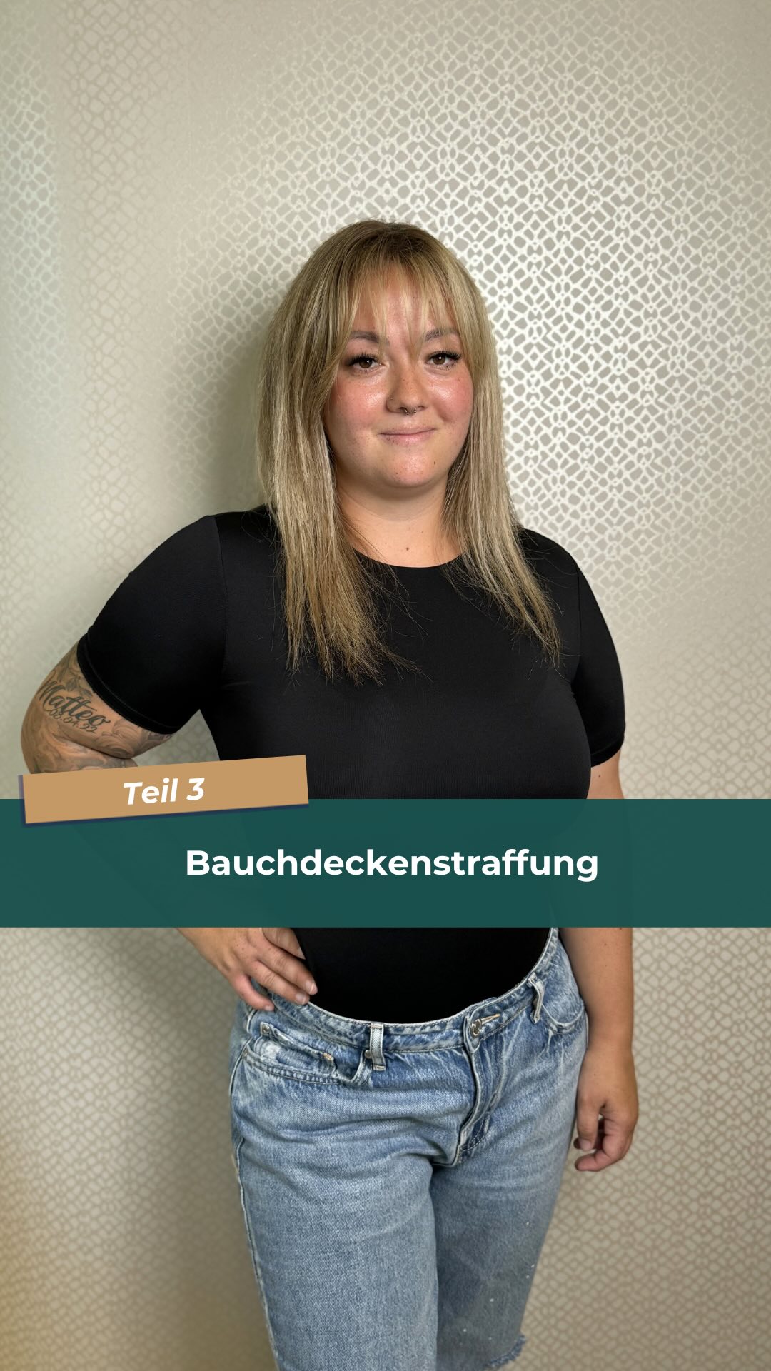 Die Reise geht zu Ende…✨

Nach der OP: Ninas Weg zu neuem Selbstbewusstsein! ✨ 

In dem letzten Teil unserer Mini-Doku🎬 teilt Nina ihre ehrlichen Gedanken und Gefühle über die Veränderungen, die sie nach ihrer OP durchlebt hat.🙌🏻 
Ihr seht ihr neues ich, welches wir euch aufgrund medizinischer Indikation zeigen dürfen.🧑🏻‍⚕️

Wie fühlt sie sich nach der OP? Wie hat sich die OP auf ihr Selbstbewusstsein ausgewirkt? Würde sie sich noch mal für ihre Behandlung entscheiden? All das beantwortet euch Nina heute!✨
-
-
-
-
-
-
-
-
#medizin #medicine #bauchdeckenstraffung #bauchdeckenstraffungstuttgart #bauchdeckenstraffungtransformation #transformation #transformationtuesday