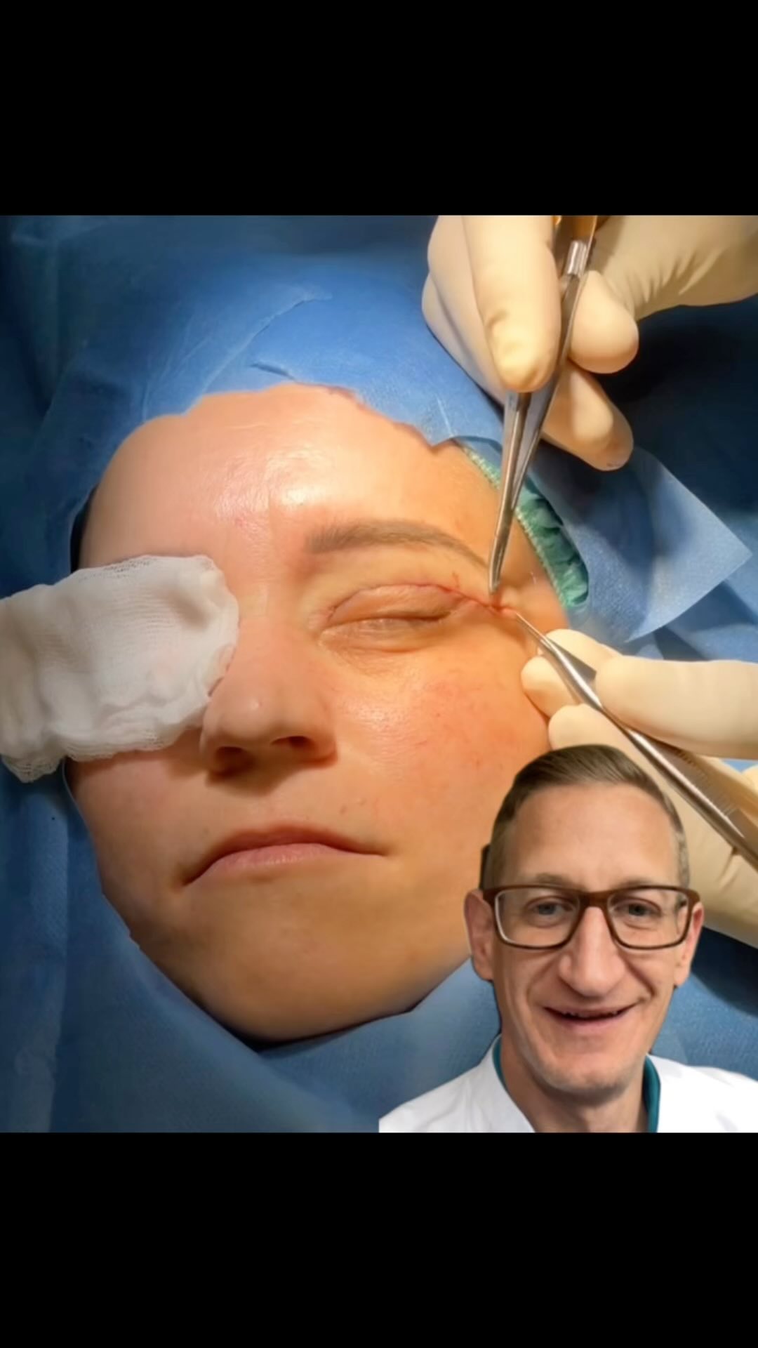 Die Lidstraffung ist einer meiner Lieblings-OPs