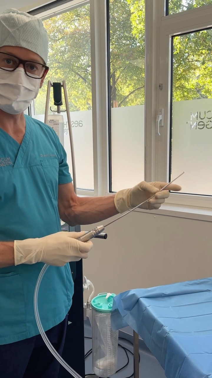 Wasserstrahlassistierte Liposuktion